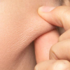 Collagen: The Building Blocks of Your Skin