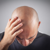 Why Men Go Bald – And Smart Solutions for Hair Loss
